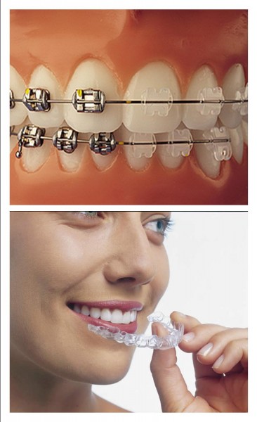 all-braces