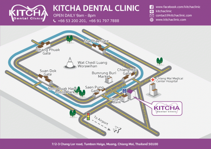 MAP OF KITCHA DENTAL CLINIC CHIANG MAI
