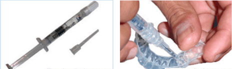 Bleaching gel loading procedure.