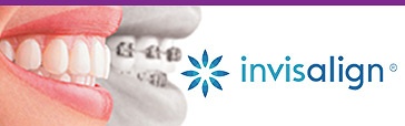 invisalign_kitcha_dental_chiang_mai