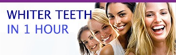  teeth_whitening_kitcha_dental_clinic_chiang_mai