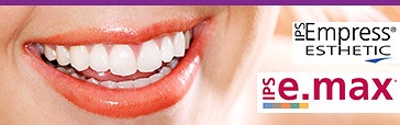 veneer_kitcha_dental_chiang_mai