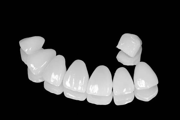 FB_Veneers 001