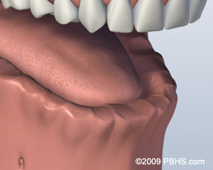 Kitcha Dental Clinic Chiang Mai Thailand dentist implant veneer crown bridge ทำฟัน จัดฟัน ฟอกสีฟัน รากเทียม