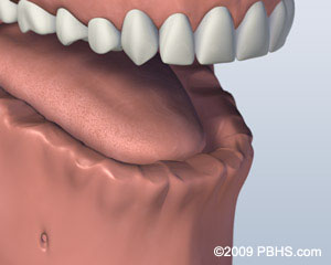 Kitcha Dental Clinic Chiang Mai Thailand dentist implant veneer crown bridge ทำฟัน จัดฟัน ฟอกสีฟัน รากเทียม