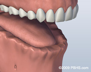 Kitcha Dental Clinic Chiang Mai Thailand dentist implant veneer crown bridge ทำฟัน จัดฟัน ฟอกสีฟัน รากเทียม